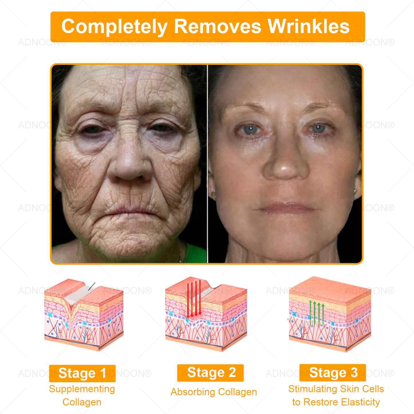 ADNOON® 7 Day Quick Skin Repair Cream-Relieves Scars, Acne, Burns, Rashes, Wrinkles & More