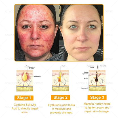 ADNOON® 7 Day Quick Skin Repair Cream-Relieves Scars, Acne, Burns, Rashes, Wrinkles & More